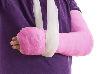 Arm cast - bright pink long arm cast in a sling for a broken elbow, arm, or wrist.  Arm covered in  plaster / gypsum / fiberglass.  Isolated on white.の写真素材