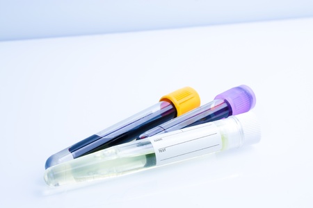 chemical test tube with blue tint on the tableの写真素材
