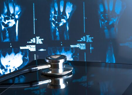 medical stethoscope on modern digital tablet pc in laboratory on x-ray images background. Concept of...