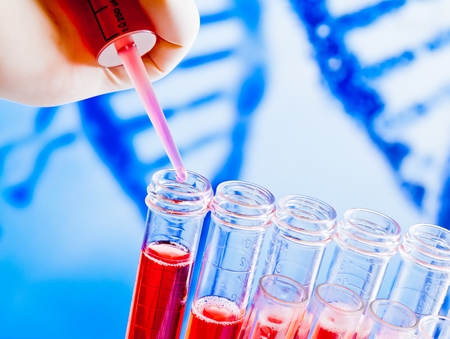 closeup of test tubes with pipette on red liquid on blue blur abstract dna backgroundの写真素材