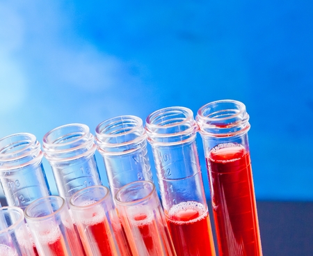 closeup of test tubes with red liquid in laboratory on blue light tint background