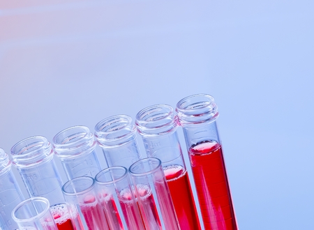 closeup of test tubes with red liquid in laboratory on blue light tint background