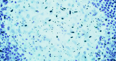 bacteria or germs microorganism cells under microscope in the color chemical blue fluid, slowing...