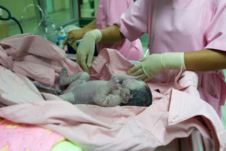Baby just born. And nurses to remove oxygen from the lungs first
の写真素材
