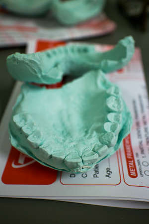 Print dentures