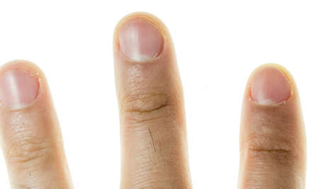 male finger close-up on a white background