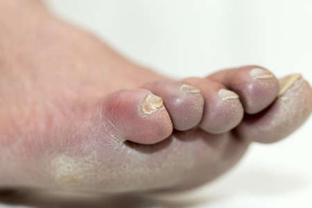 leg man close up, on a white backgroundの写真素材