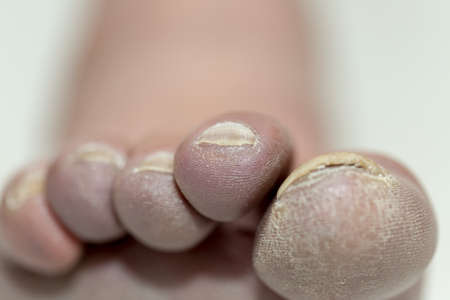 leg man close up, on a white backgroundの写真素材