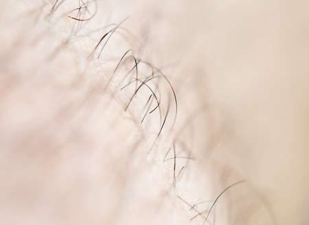 Hair on the body of the macro