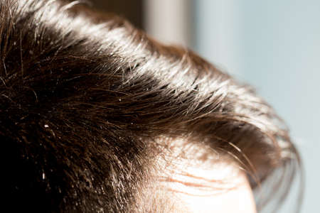 Hair close-up view from aboveの写真素材