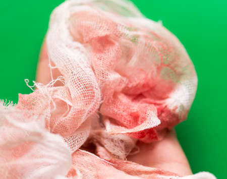 treatment of a wound on the leg, a nail grew inside done a mini operationの写真素材