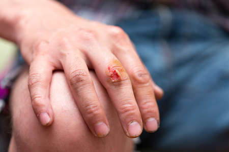 wound on the fingerの写真素材
