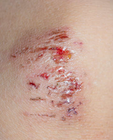 Wound on the skin of a macro