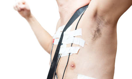A man wears a Holter device, a device for daily ECG monitoring. Treatment of heart defectsの写真素材
