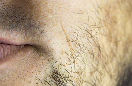 Bearded young man, stubble near. Unshaven more than a week. Hair on the face of a man, a short beard.の写真素材