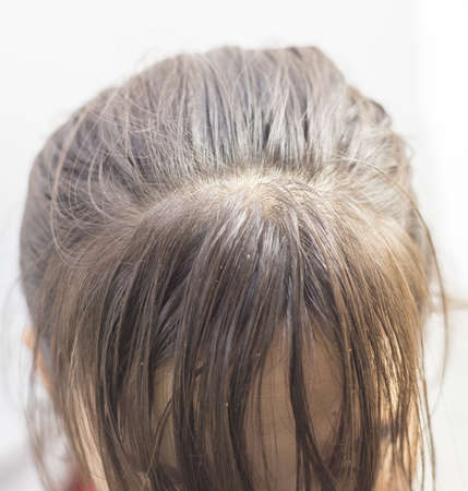 Charming brunette is not happy with fragile hair, on a white background.