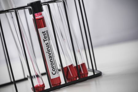 Testing patients blood samples for Coronavirus Outbreak (COVID-19) in the laboratory, New...