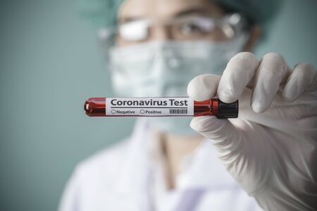 Nurse holding testing patients blood samples for Coronavirus Outbreak (COVID-19) in the laboratory, New coronavirus 2019-nCoVの写真素材