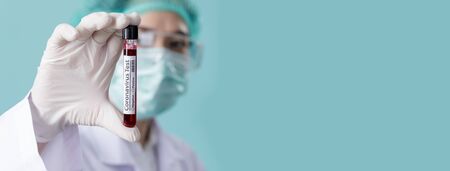Nurse wearing respirator mask for stop Coronavirus Outbreak (COVID-19) and holding testing patients blood samples for Corona Virusの写真素材