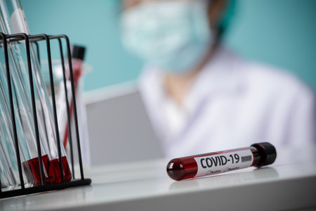 Testing patients blood samples for Coronavirus Outbreak (COVID-19) in the laboratory, New...