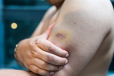 View of man in pain touching his bruised arm. Close upの写真素材