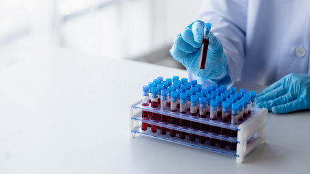 Lab assistant, a medical scientist, a chemistry researcher holds a glass tube through the blood...