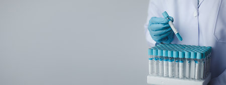 Lab assistant, a medical scientist, a chemistry researcher holds a glass tube through the blood...