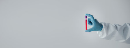 Laboratory is used for scientific research to examine and research blood obtained by sampling of patients from hospitals, lab assistants collecting blood samples from patients. Laboratory concept.の写真素材