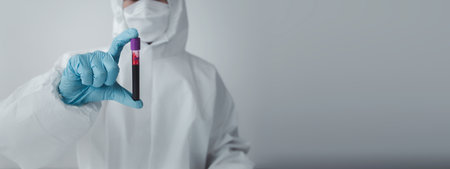 The laboratory is used for scientific research to test and research therapeutic vaccines, lab assistants collect blood samples from patients and perform chemical reactions. Laboratory concept.の写真素材