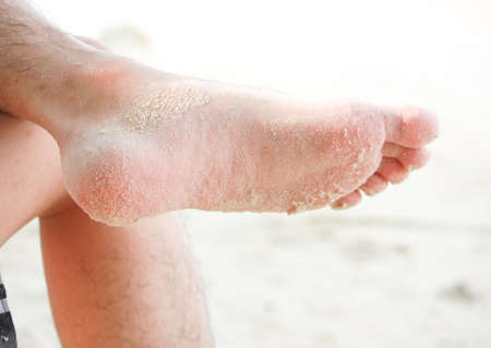 Comfortable human feet on the beach with sandの写真素材