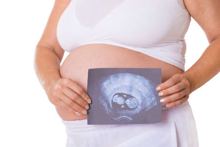Pregnant woman holds an ultrasound image in hand isolated on white background