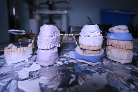 Denture cast in plaster for the dentist