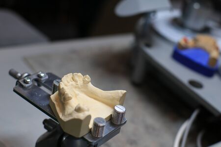 Denture cast in plaster for the dentistの写真素材