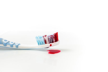 Tooth brush with blood drops on white background, soft focus