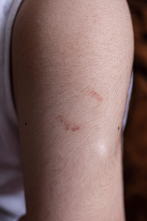 Marks and pattern visible on arm closeup, soft focus