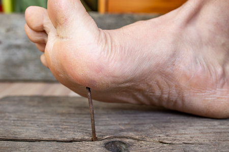 Bare foot stepping on a sharp rusty nail from a weathered wooden board, close upの写真素材