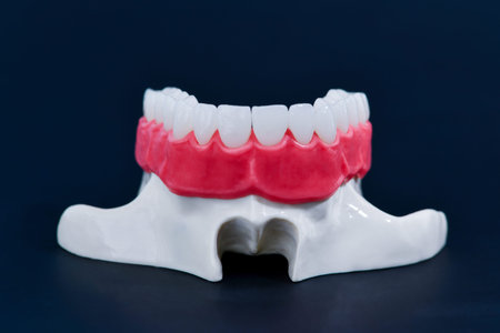 Upper human jaw with teeth and gums anatomy model medical illustration isolated on blue background....