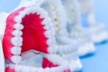Dentist orthodontic teeth models with jaws opened on blue backgroundの写真素材