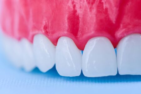 Upper human jaw with teeth and gums anatomy model medical illustration isolated on blue background. Healthy teeth, dental care and orthodontic conceptの写真素材