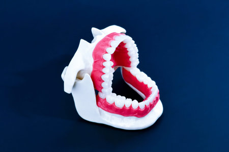 Dentist orthodontic teeth model with jaw opened on blue background