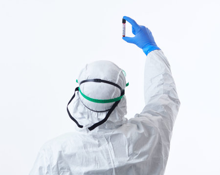 Coronavirus, Doctor holding positive covid-19 virus Blood Sample test tube. Wearing biohazard...