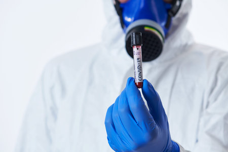Coronavirus, Doctor holding positive covid-19 virus Blood Sample test tube. Wearing biohazard...