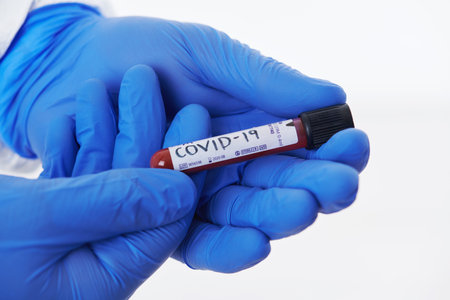 Coronavirus, Doctor holding positive covid-19 virus Blood Sample test tube. Wearing biohazard...
