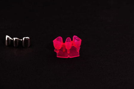 Teeth implant and crown installation process parts isolated on a black background. Medically...