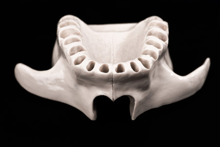 Upper human jaw without teeth model medical implant isolated on black background. Healthy teeth, dental care and orthodontic concept.の写真素材