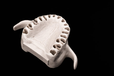 Upper human jaw without teeth model medical implant isolated on black background. Healthy teeth,...