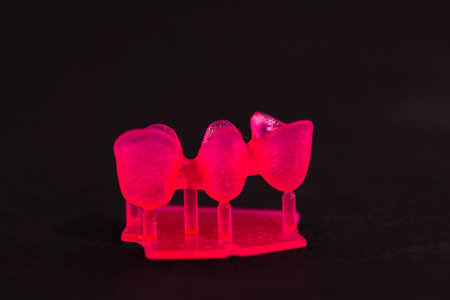 Teeth implant and crown installation process parts isolated on a black background. Medically...