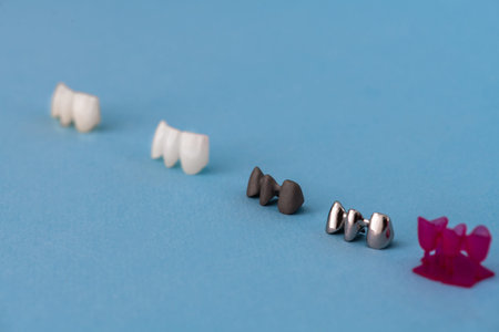 Teeth implant and crown installation process parts isolated on a blue background. Medically accurate...