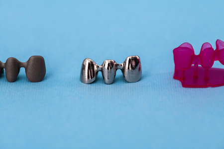 Teeth implant and crown installation process parts isolated on a blue background. Medically accurate...