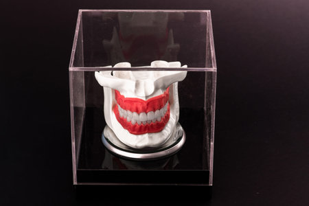 Human jaw with teeth implants anatomy model isolated on black background in a glass box.